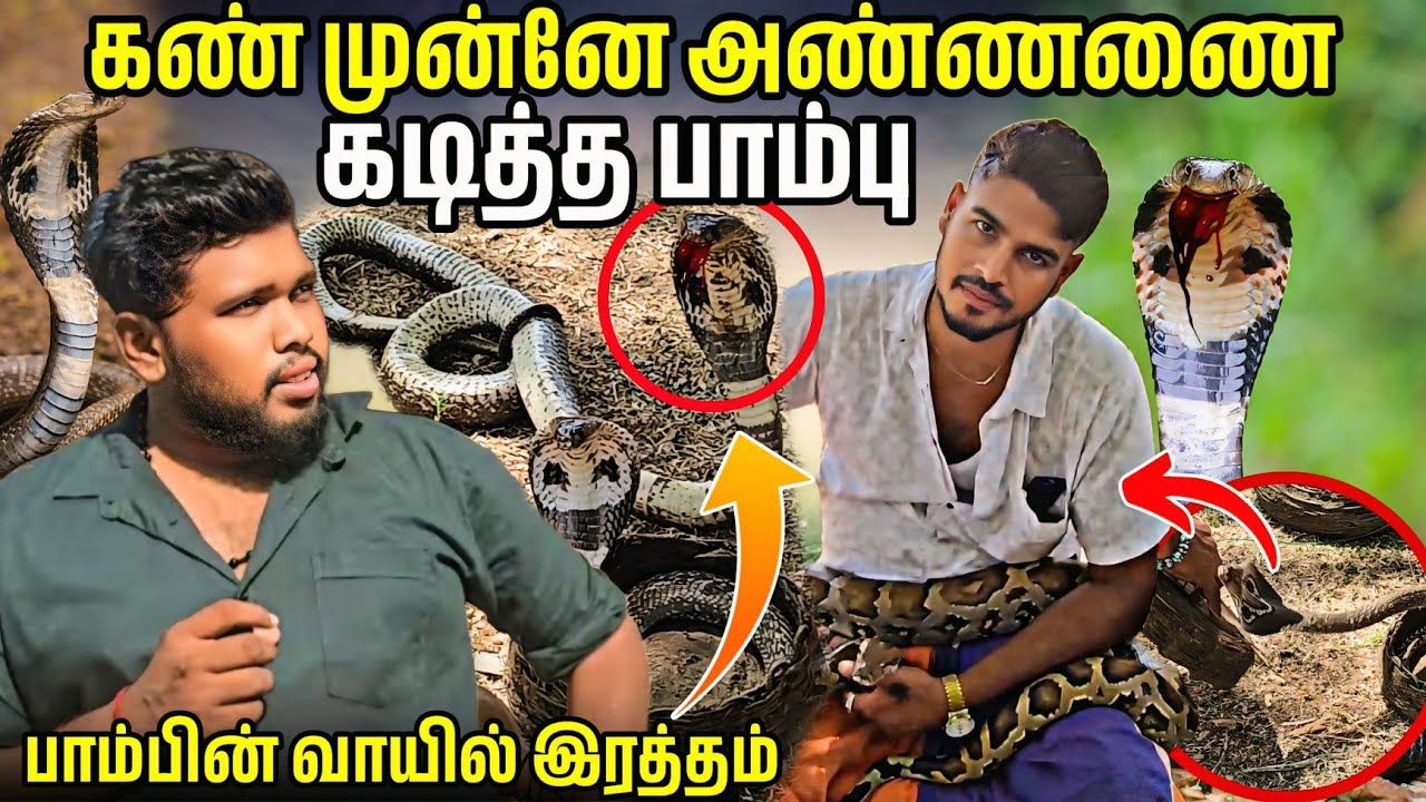 கண் முன்னே அண்ணாவின் கையை கடித்த நகம் 😱 | Voice of Anushan 