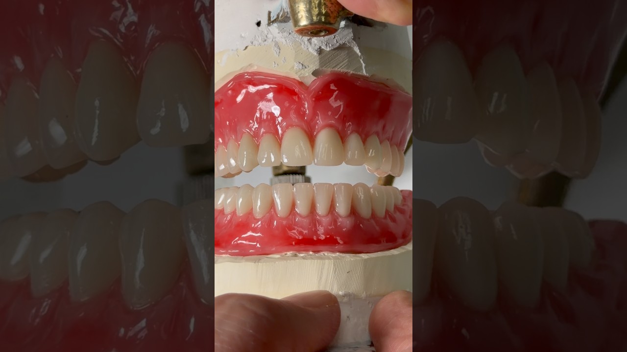 Wax try-in for Dr. William Bennett in Illinois