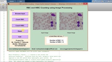 RBC and WBC Detection matlab project source code