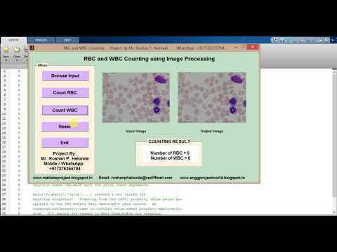 RBC and WBC Detection matlab project source code
