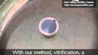 Egg Freezing through Vitrification