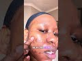 My Simple Skincare Routine for Clear, Healthy Skin While Healing Acne ✨