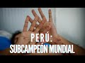 Perú subcampeón mundial ¡Protégete de la viruela del mono! #5denoviembre
