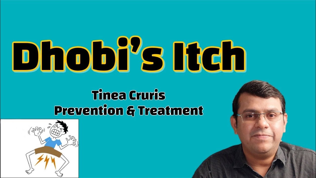 Dhobi's Itch Tinea Cruris Prevention & Treatment YouTube