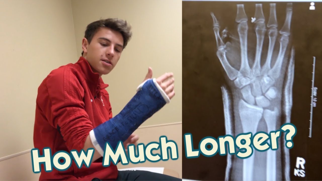 It's Back At The Doctor's Office for His Broken Arm How Much Longer
