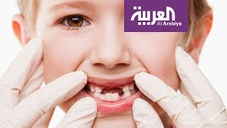 صباح العربية: كيفية الحفاظ على الأسنان الدائمة التي تظهر عند الأطفال
