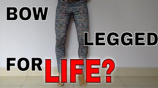 Bow Legs Yoga - How To Get Straight Legs Naturally? The Absolute Truth