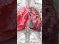 What Vaping Does to Your Lungs 😳  3D Anatomy Animation #shorts #anatomy