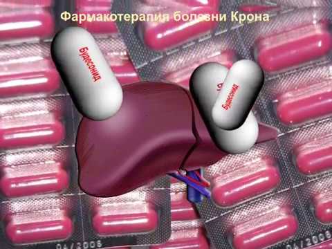 Фармакотерапия болезни Крона © Pharmacotherapy Crohn's disease