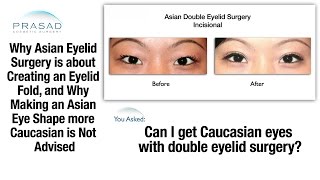 Why Changing Natural Asian Double Eyelids Into A Caucasian Shape Is Not Possible Or Advised