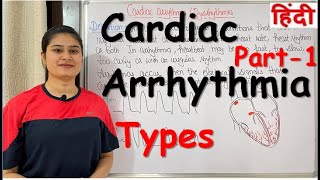 Cardiac Arrhythmia  | Part-1 | Types of Cardiac Arrhythmia | RajNEET Medical Education