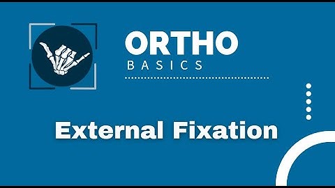 Ortho Basics: External Fixation