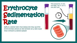 Erythrocyte Sedimentation Rate (ECR) Test: Purpose, Procedures and Test  Results