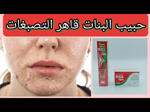 تجربتي مع فيسكا فورت لمعالجة التصبغات والبقع في 3 دقائق فقط ستعشقينه 