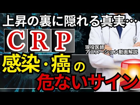 第7回【内科専門医解説】CRPについて　【血液検査編】