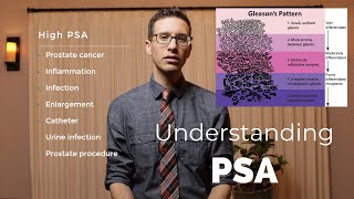 What PSA is and why it's important explained by urologist