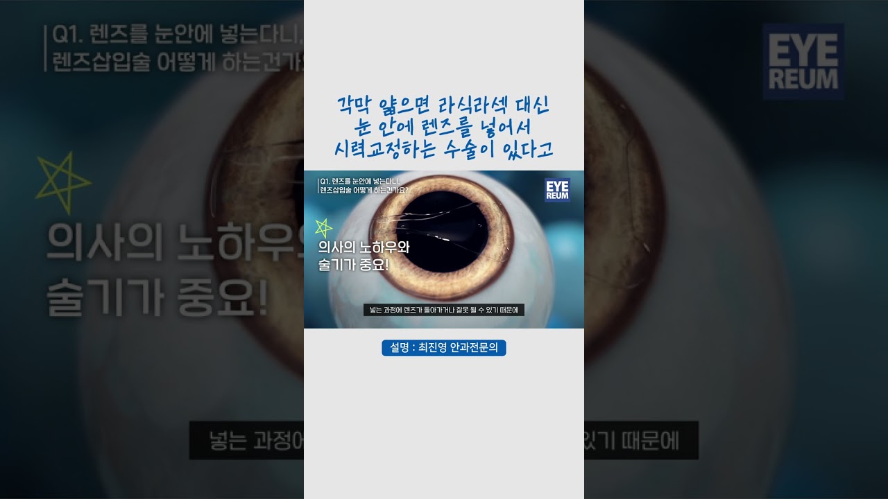 [Phòng khám mắt Eyerium] Phẫu thuật chỉnh thị bằng cách đặt #Thấu_kính_ICL vào mắt, công bố quy trình phẫu thuật #Đặt_thấu_kính