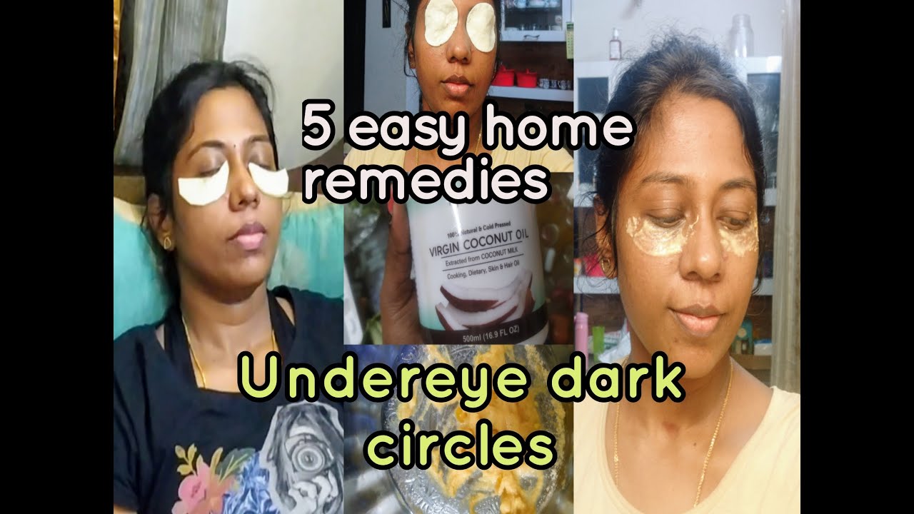 How to remove dark circles permanently with easy home remedies,under