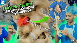 1       Peld Advanced Treatment  Details