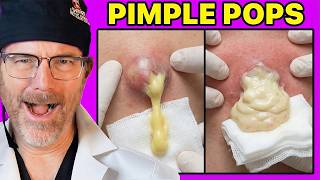Plastic Surgeon Reacts to the BIGGEST Pimple Pops on the Internet - Safe or Seriously Risky?