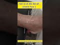 #doctor #pain #acupuncture #holistichealth #heel #foot #health #jointpain #muscle