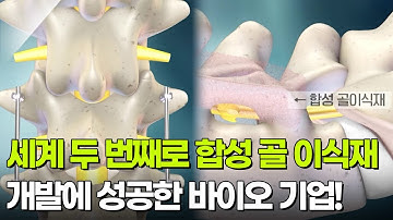 세계 두 번째로 합성 골 이식재 개발에 성공한 바이오 기업! [넥스트 챔피언의 비밀병기] | KBS 251207 방송