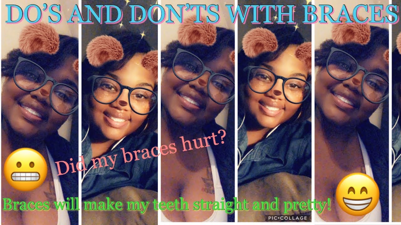 Dos  Donts With Braces 2019 - Youtube-8032