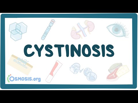 Cystinosis - causes, symptoms, diagnosis, treatment, pathology