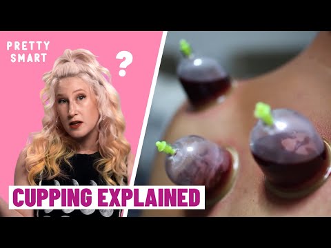 Video: Hur Känner Cupping Verkligen?