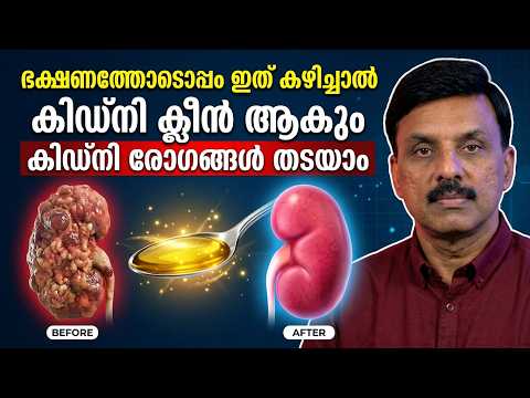 ഭക്ഷണത്തോടൊപ്പം ഇത് കഴിച്ചാൽ കിഡ്‌നി ക്ലീൻ ആകും കിഡ്‌നി രോഗങ്ങൾ തടയാം Dr Jeevan / kidney food