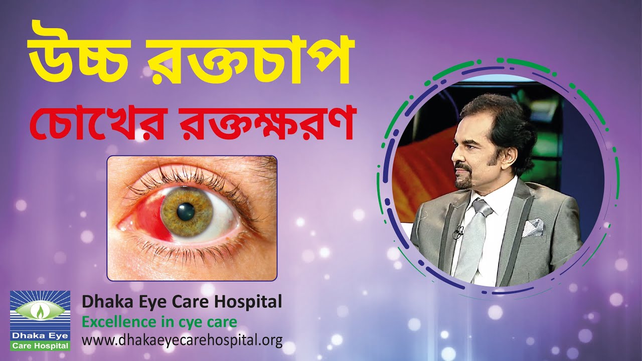 Bleeding of The Eye Due to Hypertension Prof. Dr. Harun Ur Rashid