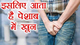 Blood in Urine | पेशाब में खून आना हो सकता है ख़तरा, जानिए क्या होतें हैं कारण | Boldsky Blood in Urine | पेशाब में खून आना हो सकता है ख़तरा, जानिए क्या होतें हैं कारण | Boldsky