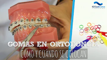 ¿Cuándo ponen ligas en los brackets?