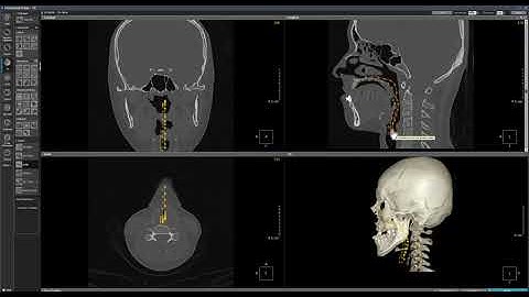 OnDemand3D Tool Tip   CPR3D module