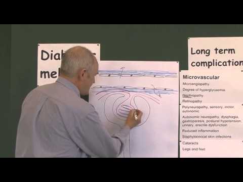 Diabetes 19, Microvascular Complications