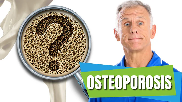 3 Things You Should NEVER Do If You Have Osteoporosis. PLUS Exercises You Should Do. - DayDayNews