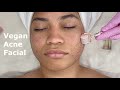 5 Step Vegan Skincare Facial {Sensitive/Acne} to Renew Skin!