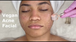 5 Step Vegan Skincare Facial Sensitive/Acne to Renew Skin