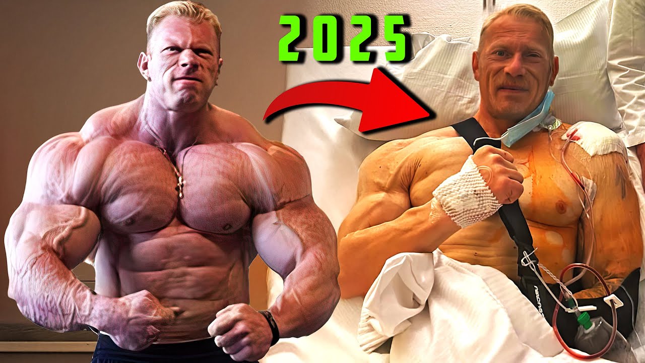 ДЕННИС ВУЛФ СЕЙЧАС 2025 — Я ПОТЕРЯЛ ВСЮ НАБИТУЮ МЫШЕЧНУЮ МАССУ