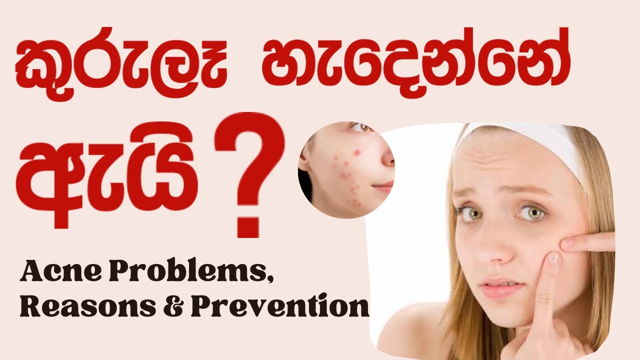 කුරුලෑ හැදෙන්නේ ඇයි? | Acne Problems, Reasons & Prevention | Salon Teacher Academy