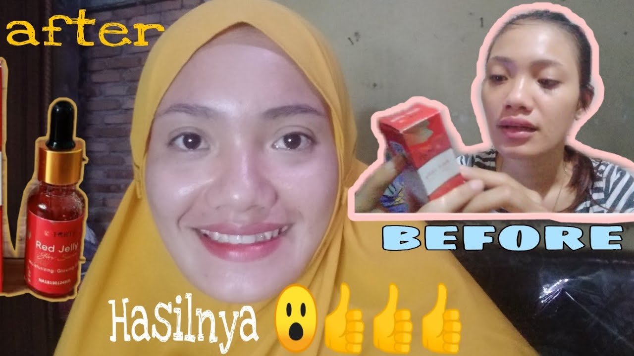 serum red jelly