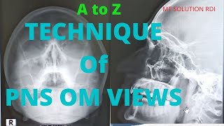 Technique of x-ray PNS om views (Ep-26) | x-ray PNS water view Positioning | Bangla tutorial