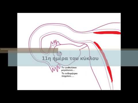 Βίντεο: Πώς να κάνετε ντους κατά την εμμηνόρροια: 7 βήματα (με εικόνες)