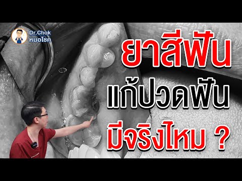 อันตราย!!! อย่าหลงเชื่อ ยาสีฟันที่แก้ปวดฟัน มีจริงไหม !!? | คลายปัญหา รากฟันเทียมกับหมอโชค