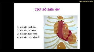 Bài 3: Kỹ thuật siêu âm tim  I PGS.TS  Trần Kim Trang