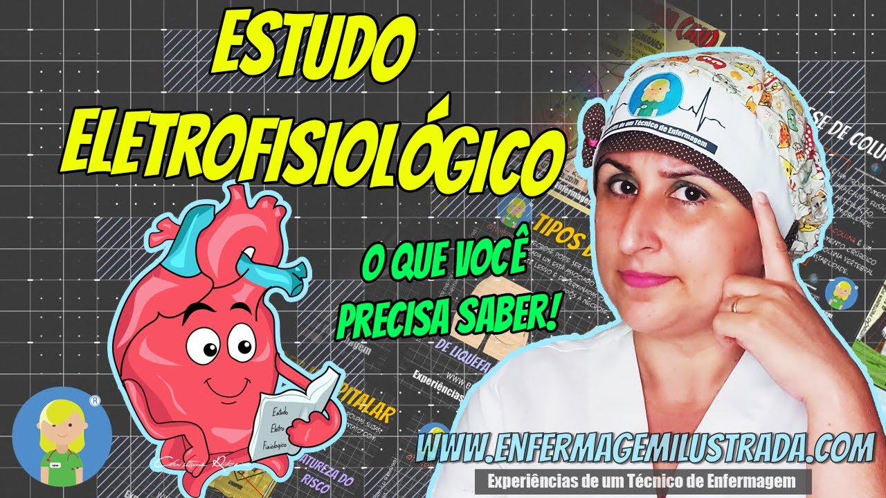Estudo Eletrofisiológico - Saiba mais sobre o procedimento!