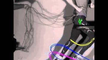 Treadmill Running (500fps) Quintic Biomechanical Analysis