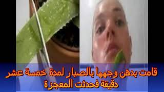 قامت بدهن بشرتهاا بالصبار ?لمده 15 دقيقه فحدثت المعجزه