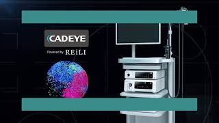 Cadeye Powered By Reile