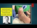 Injection - dorsal midfoot OA CSI training video